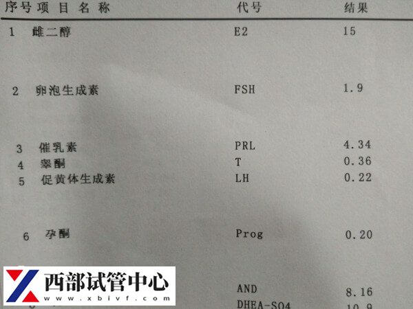 女人雌性激素过高会怎么样