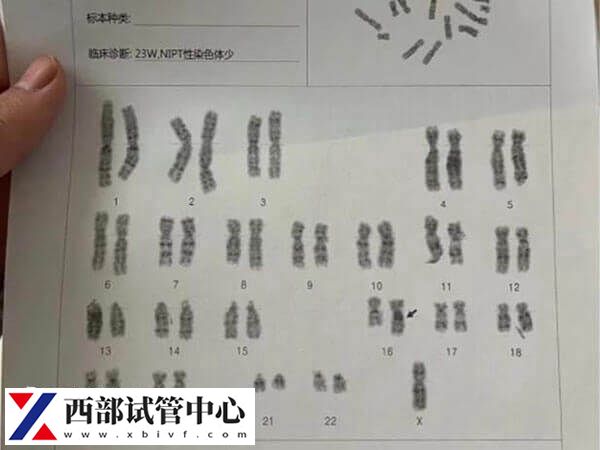 二代试管不可以筛查染色体